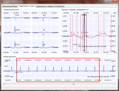 Screenshot of the application ECG Control - #1