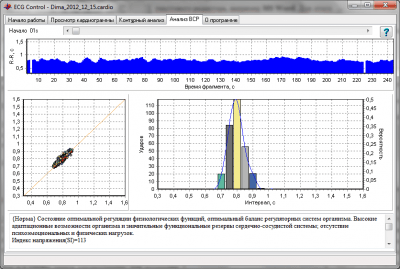 Screenshot of the application ECG Control - #3