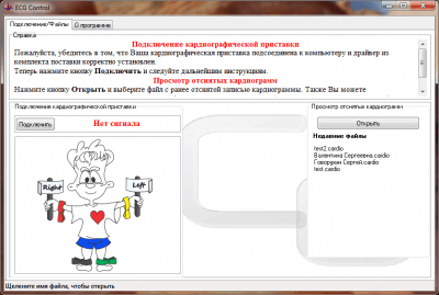Screenshot of the application ECG Control - #4