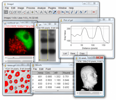 Screenshot of the application ImageJ - #1