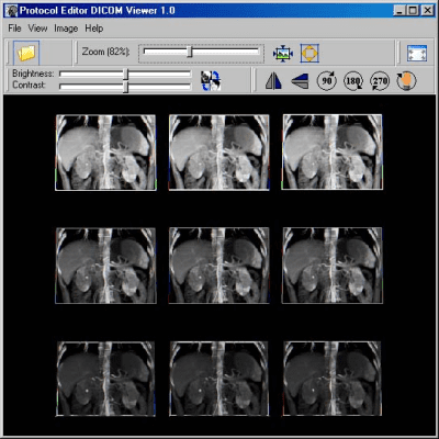 Screenshot of the application DICOM Viewer - #1