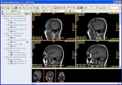 Screenshot of the application Escape Medical Viewer - #1